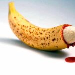Обрезание пениса
